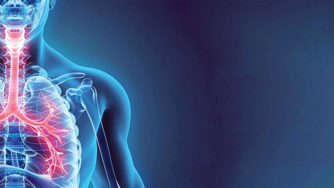 بیماری‌های دستگاه تنفسی در ایران؛ درمانی که به همه نمی‌رسد